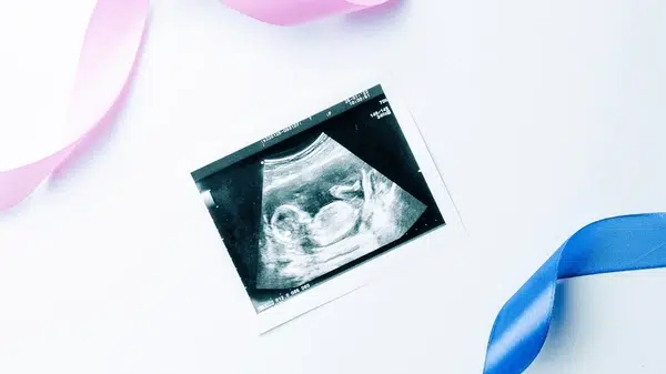 Types of Pregnancy Scans