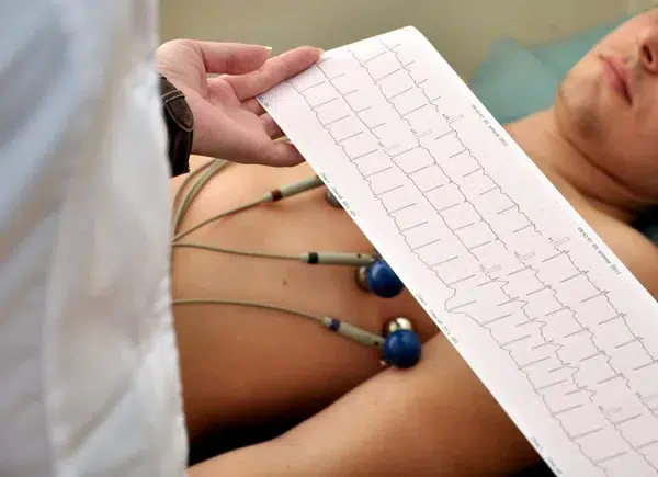 Doctor reviewing ECG report for heart health assessment