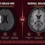 DWI MRI Brain