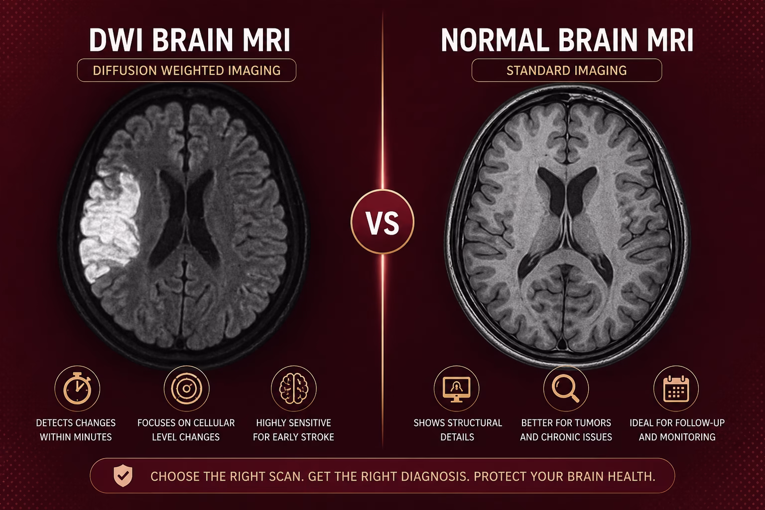 DWI MRI Brain