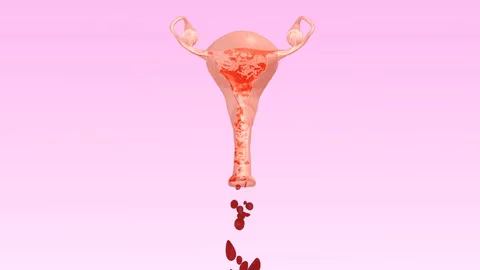 abnormal menstruation