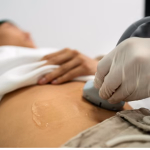 Ultrasound Upper Abdomen