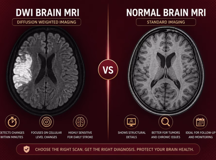 DWI MRI Brain