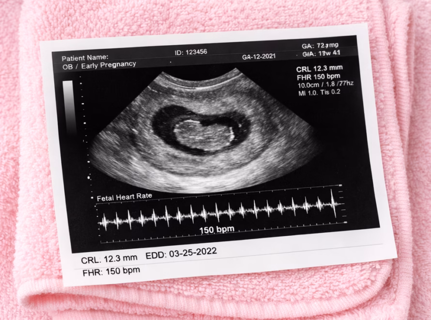 Pregnancy Scan
