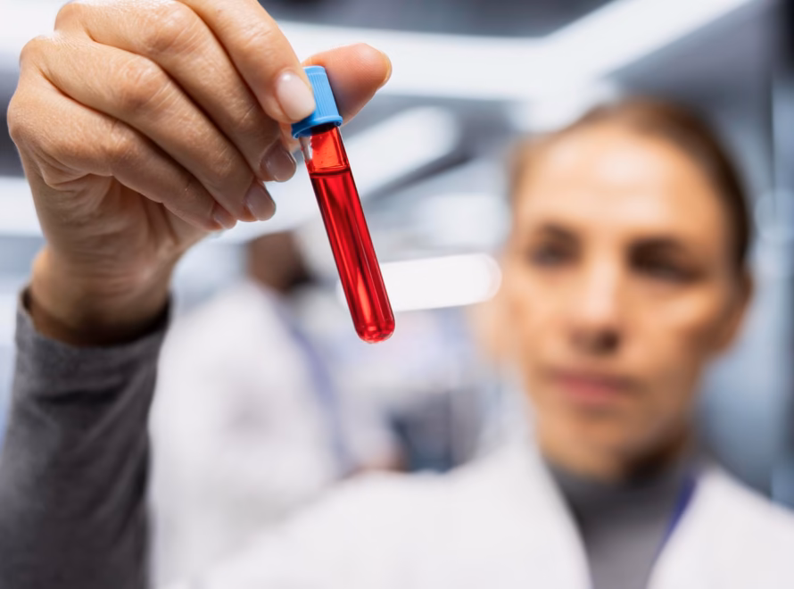 Doctor holding a blood test tube for a vitamin profile blood test in Dubai
