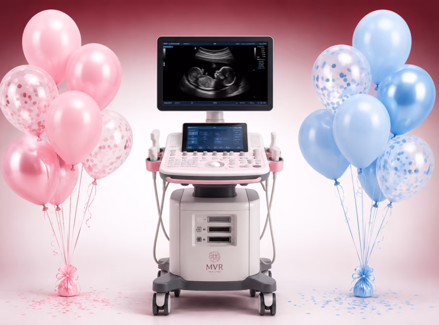 Early Gender Ultrasound