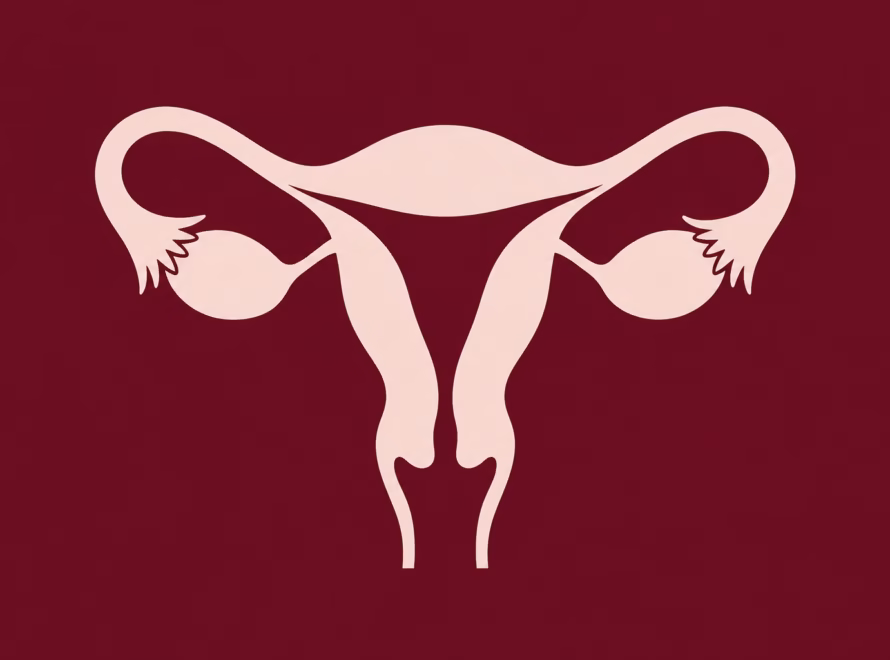 PCOS