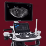 USG Pelvis TVS Scan